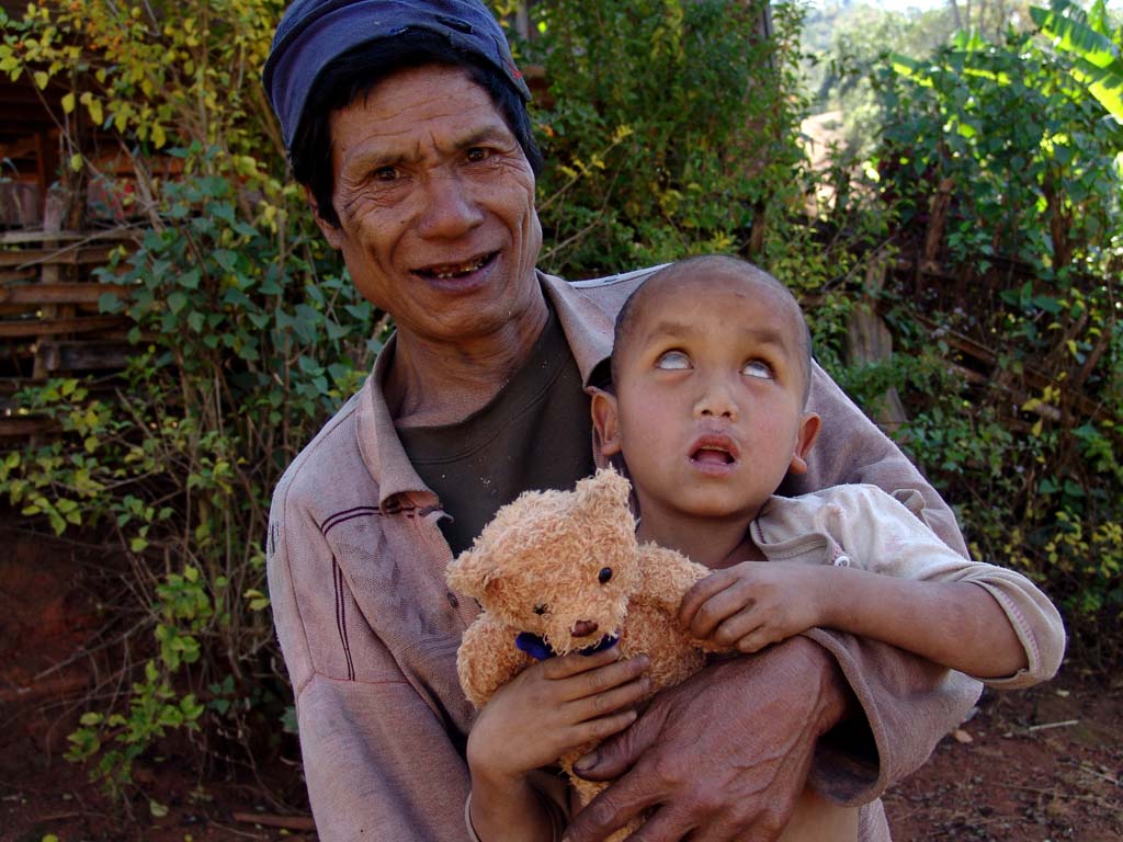 Father With Blind Son